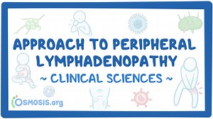Approach to peripheral lymphadenopathy: Video & Meaning | Osmosis