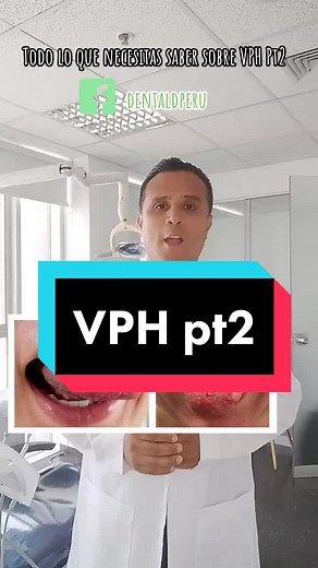 Síntomas de VPH y problemas en la lengua