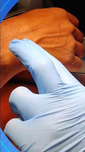 IV line insertion tips