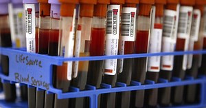US blood banks hit ‘unprecedented’ critical shortage