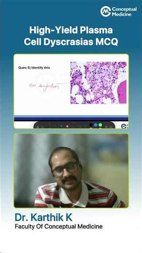 Plasma Cell Dyscrasias MCQ Discussion | NEET SS & INI-SS Preparation | Dr. Karthik K