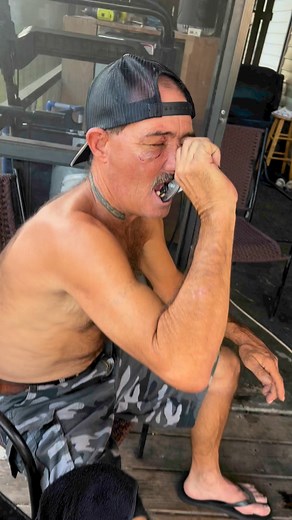 Johnathon Gentry on Instagram: "Redneck Tooth Extraction #fypシ゚ #dentistry #redneck #viralpost #viralshorts #viralvideo #florida"