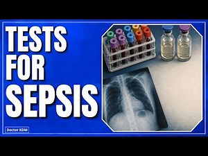 How Do Doctors Test for SEPSIS?