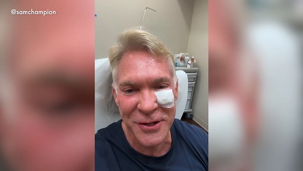 WATCH: Sam Champion documents his battle with skin cancer
