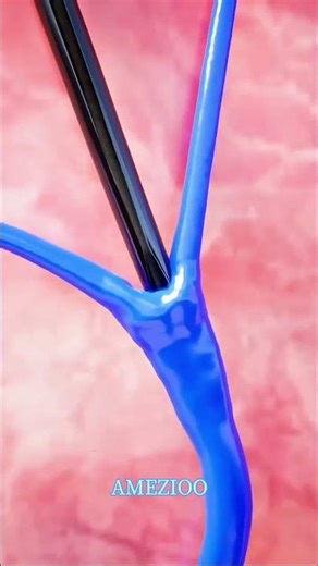 How a mosquito 🦟 bite a human