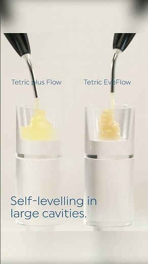 Tetric® plus – Smart proof #5- Self-levelling | ivoclar