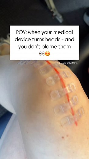 BRIJ Medical | Insider Scoop👀🧐: They’re called Brijjits and they help you heal beautifully after surgery by eliminating tension on your incision at and... | Instagram