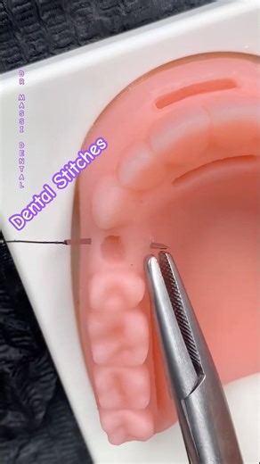 Dental stitches Demo Video