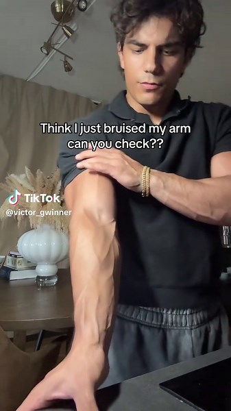 How to Check for Arm Bruises Safely