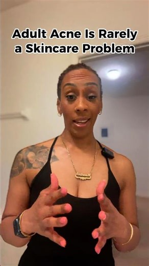 Adult Acne Is Rarely a Skincare Problem (Here’s Why)