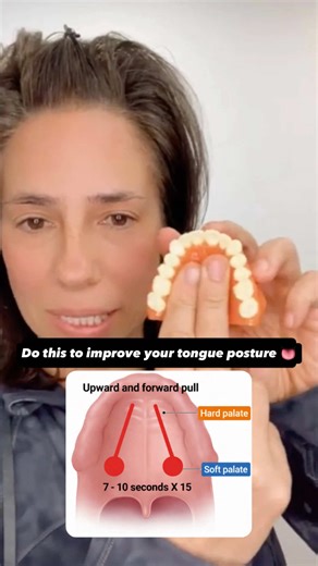 You’ve been doing these tongue exercises for months. Every 2 hours. Upward pull. Sideways pull. Holding your tongue on your palate. When you remember to do them? Your jaw feels better. Your posture improves. Your breathing gets easier. But the moment you stop thinking about it? Everything drops back. Here’s what nobody tells you: These exercises only work when you’re conscious. You can hold perfect tongue posture when you’re awake and focused. But 8 hours a night while you sleep? Your tongue dro