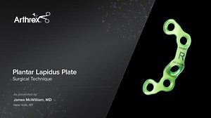 Plantar Lapidus Plate