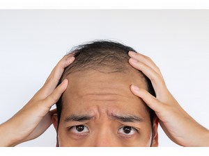 Dear Abby: Man can’t brush off friend’s secrecy about hair growth treatment