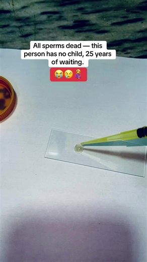 41-year-old male trying for a baby for 25 years😭#semenanalysis #fertiityawareness #learnontiktok #medical #viral