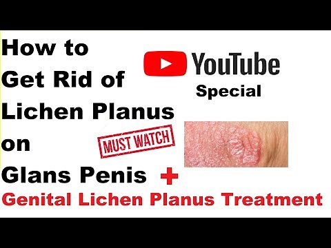 How to Get Rid of Lichen Planus on Glans Penis & Genital Lichen Planus - Instant Relief