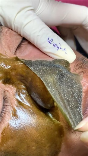 Deep Cleansing Face Mask for Clear & Glowing Skin😱😱😱😱