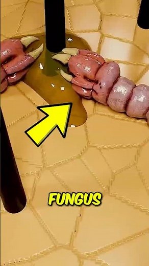 Why Your Scalp Keeps Flaking Without You Knowing 🤯