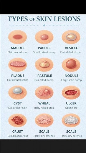 12 Types OF Skin Lesions You Should Never Ignore 🩺😱