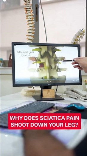 Why does Sciatica Pain Shoot Down Your Leg?