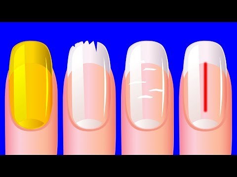 Ce Que Tes Ongles Révèlent Sur Ta Santé