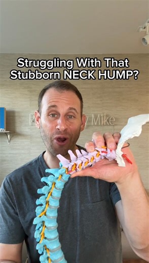 Say goodbye to neck humps with the Static Extension Position! This simple yet powerful exercise helps to engage and strengthen the muscles in the upper back and shoulders, which can help counteract the forward pull that contributes to a neck hump. #PostureFix #SpineHealth #BackPainRelief #PostureMatters #NeckPain #WellnessJourney #BodyAlignment #Ergonomics #FitnessTips #HealthyLiving #PainManagement #SelfCare #ChiropracticCare #mobilitymatters | PostureStrong