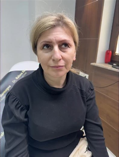 4.7K views · 19 reactions | Tratament personalizat pentru un look mai fresh, mai putine riduri, iar declaratia pacientei de 100 puncte “Nici nu trebuie sa mai folosesc faceapp”朗 #drralucaharnagea #skincare #filler #glowingskin #facialtreatment #doctor #dermatolofy | Dr. Raluca Harnagea | Facebook