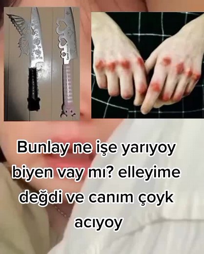 Canım acıyoy... #yağızaaşığımdiyincekeşfetoluyormuş #babyruby #keşfet #fypシ゚viral #fyppppppppppppppppppppppp