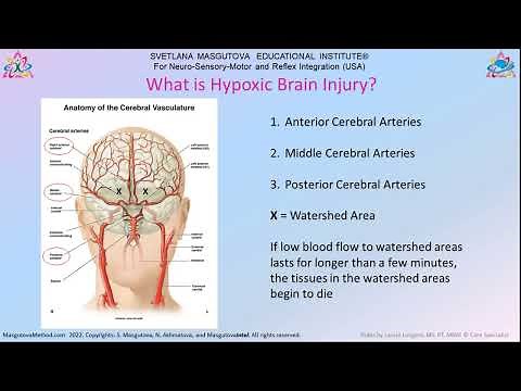 MNRI®: A Spark of Hope for Hypoxic Brain Injuries