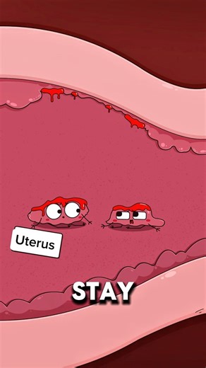 Why a Missed Period Could Mean Uterine Polyps ⚠️🩸..!!#e2dhealth #animation #2dshow #health #fypシ