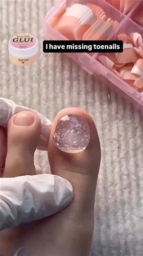 For missing toenails try Secret Nails GLUI nail glue, it holds longer than Acrylic & poly gel