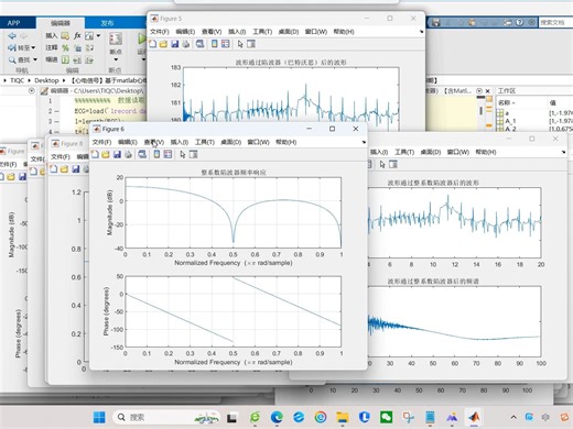 【心电信号】基于matlab心电信号预处理滤波器设计（FIR滤波器和IIR滤波器巴特沃思，切比雪夫，椭圆滤波器）【含Matlab源码 3789期】