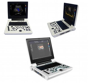 [Hot Item] Portable Color Doppler Ultrasound Machine for Accurate Diagnostics