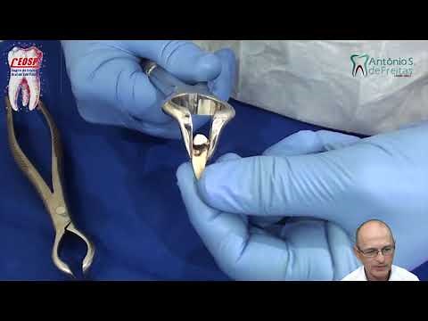 Como deve ser o forceps para extrair o pré molar inferior. Dr. Antônio Sergio Freitas
