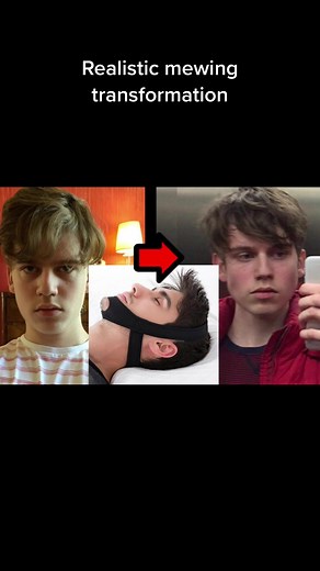 Realistic Mewing Transformation - Tips and Results | TikTok