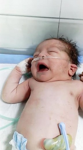 Newborn Oxygen Dependent Baby Care | Safe Handling & Monitoring Tips 👶💙 #baby #newborncare