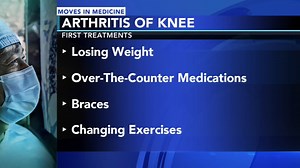Knee Osteoarthritis: Procedure brings comfort, resolves pain for even most surgery-averse patients