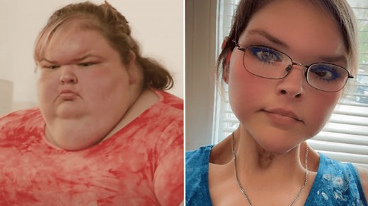 1000-lb Sisters’ Tammy Slaton shares new photos after skin removal surgery