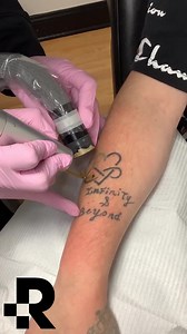 357 reactions · 26 shares | Want to remove your tattoo for good? At...