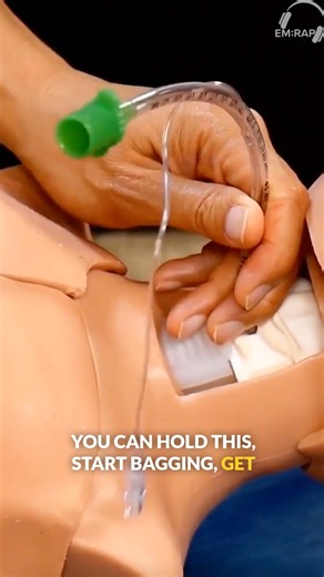 EM:RAP on Instagram: "Shiley or endotracheal tube—which is your preferred choice for a surgical airway? Check out this cricothyroidotomy video from trauma surgeon and longtime EM:RAP contributor Kenji Inaba for valuable tips on this critical procedure. This clip is from EM:RAP Live. Download the EM:RAP app now to watch the full video and gain even more pearls of wisdom from the master. #Meded #EmergencyMedicine #MedicalEducation #EM #EMRAP #cricothyroidotomy #trauma"