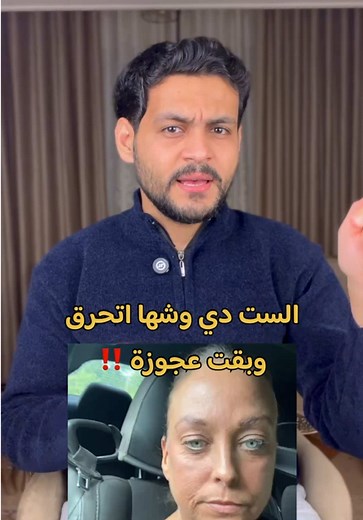 نصائح مهمة قبل استخدام كريم الريتينول للبشرة