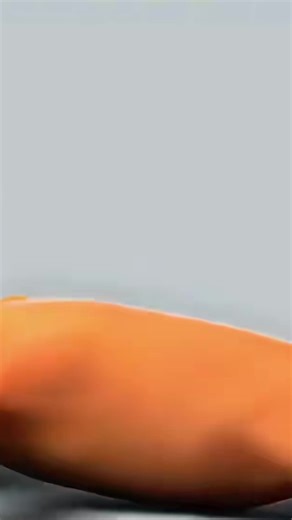 Understanding Congenital Megacolon: 3D Animation Insights