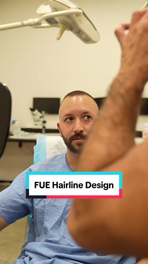 Creating the Perfect Hairline: A Comprehensive Guide