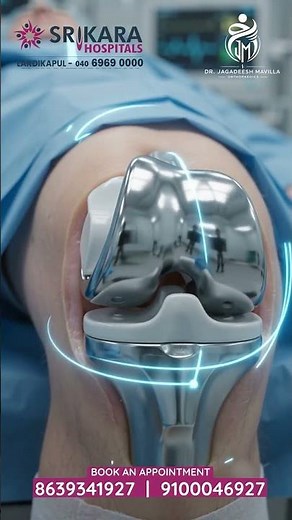 Robotic Knee Replacement with Subvastus Technique | Dr. Jagadeesh Mavilla Explains