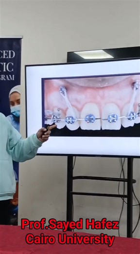 📢 Camouflage Day 🦷 تحت إشراف الأستاذ الدكتور / سيد حافظ 🦷 أستاذ تقويم الأسنان - جامعة القاهرة 📢ضمن فعاليات الأسبوع الرابع 🗓️4️⃣👌 ⚜️ Clinical Basic --» Advanced Orthodontics Course Program🦷⛓️ 📍أكاديمية الأميرة فاطمة للتعليم الطبي المهني🗺️🇪🇬 | ODEX