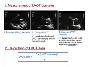 Calculation of Cardiac Output and Ejection Fraction