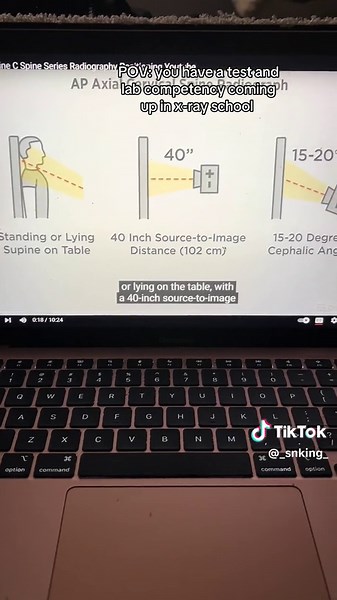 Rad tech boot camp is a life saver, if your school doesn’t offer it they have a lot of the videos on youtube. It’s a great tool to use to study! #fyp #xybca #xyzabc #radtechstudent #xraystudent #fyppppppppppppppppppppppp #radiologytechnologist #radiology #fypviralシ゚ #radiologylife #radiologytiktok #radtech #studytok