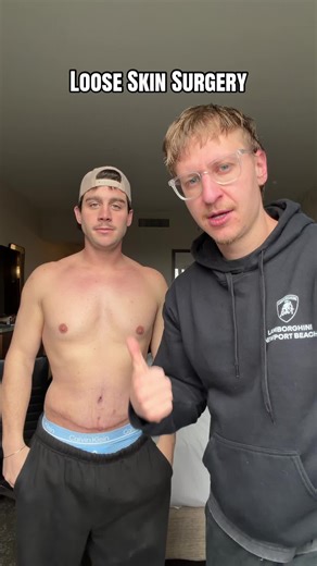 @Noah Stepherson got loose skin surgery after losing 100 pounds | Noah