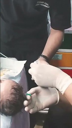 “CSF Drainage in Infant Hydrocephalus | Life-Saving Procedure”#doctor #infanthealth