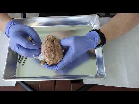 Sheep Brain- Removal of Dura Mater