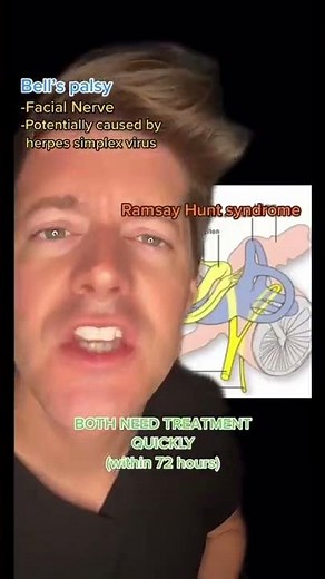Ramsay Hunt syndrome vs Bell’s Palsy - What’s the Difference??